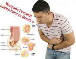 Illustration for article titled Obat Saluran Kencing Perih Sakit Seperti Ada Luka Lecet Di Apotik
